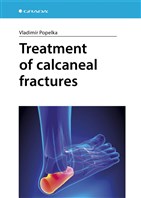 Treatment of calcaneal fractures