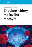 Zhoubné nádory močového měchýře