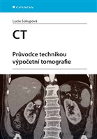 CT - Průvodce technikou výpočetní tomografie