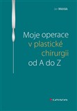 Moje operace v plastické chirurgii od A do Z