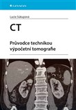 CT - Průvodce technikou výpočetní tomografie