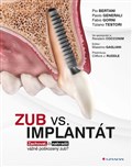 Zub vs. implantát