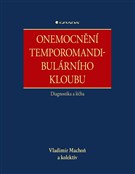 Onemocnění temporomandibulárního kloubu - diagnostika a léčba